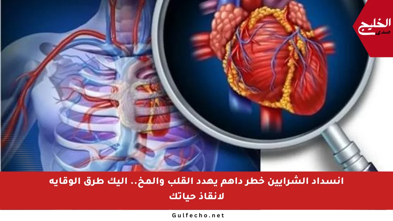 انسداد الشرايين خطر داهم يهدد القلب والمخ.. إليك طرق الوقاية لإنقاذ حياتك